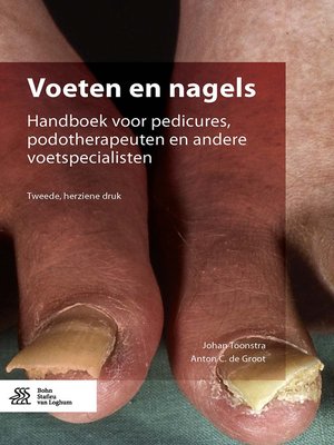 cover image of Voeten en nagels
